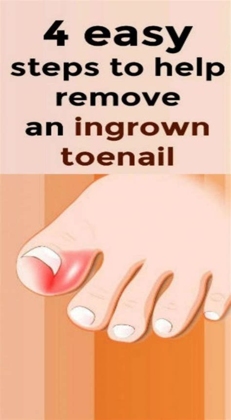 No irritation and ingrown hairs: 7 Signs, You Are Eating Too Much Sugar!!! | Ingrown toe ...