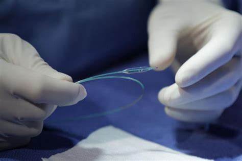 Стентирование - что это такое? Стентирование сосудов сердца: стоимость Картинка - Стентирование - что это такое? Стентирование сосудов сердца: стоимость