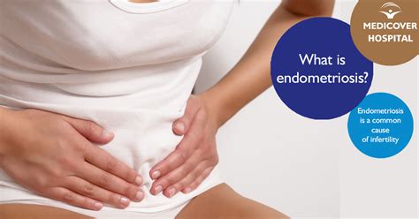 One theory is that during menstruation, blood with endometrial cells flows back into the fallopian tubes. Can endometriosis cause infertility? - Mysurgeryabroad ...