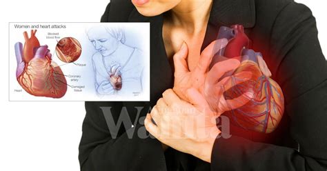 Penyakit jantung merupakan suatu keadaan dimana otot otot jantung akan mati dan tidak dapat mengalirkan darah. Petanda Awal Jantung Bermasalah, Ramai LAMBAT Sedar & Tak ...