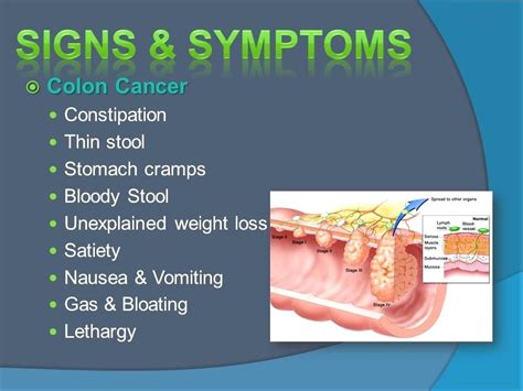 Gradually squeeze the contents of the container into the rectum. How To Colon Cleanse & Why It Is Important to Detox and ...