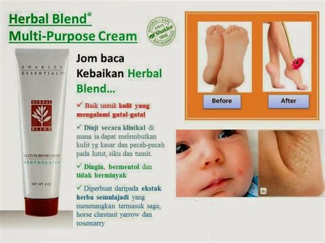 Ada banyak tips dan cara untuk hilangkan. Testimoni Herbal Blend Cream untuk kulit gatal, ekzema ...