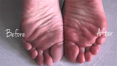 There are several types of foot soaks that can help keep your feet soft. How to Care for Your Feet: An Awesome Velvet-Smooth Device ...