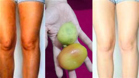 Cara putihkan kulit dengan jus segar. Cara Memutihkan Kulit Tangan Dan Kaki Dengan Cepat - YouTube