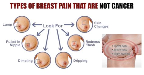 Abdominal cramps and pain during pregnancy are common, but sometimes can be a serious problem. Types Of Breast Pain That Are Not Cancer - What You Need ...