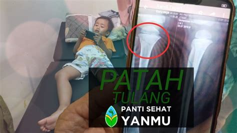 Hindari membungkus tulang yang patah yang terjadi pada kucing. Pengobatan alternatif || reposisi patah tulang bagian kaki ...