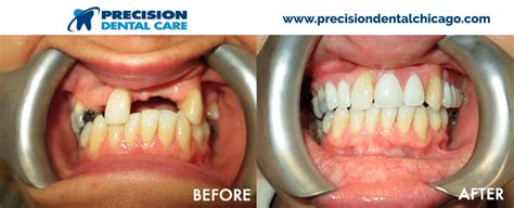 Pain free, cost effective and very considerate of the patient. Precision Dental Care | The Best Dentists in Chicago IL