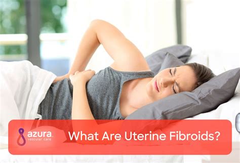 Uterine fibroids, also known as uterine leiomyomas or fibroids, are benign smooth muscle tumors of the uterus. What Are Uterine Fibroids? Understand Symptoms, Diagnosis ...