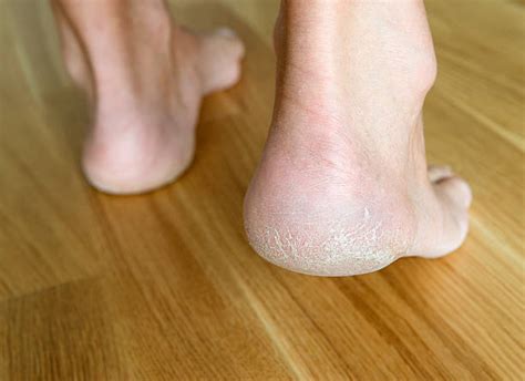 Mature feet soles (100,165 results). Mature Soles Stock Photos, Pictures & Royalty-Free Images - iStock