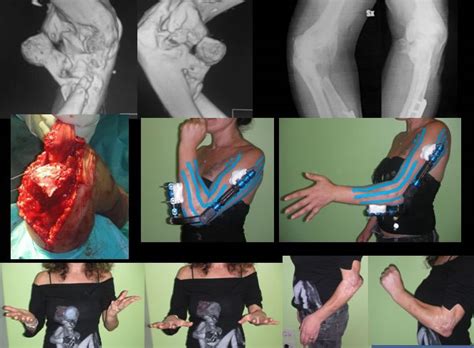 Dottor Pierluigi TOS - MD, PhD - Specialista in Ortopedia ...