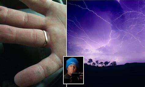 According to the national weather service, 4 percent to 5 percent of people struck by lightning were talking on. WATCH photographer Brian Skinner get struck by lightning ...