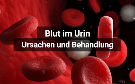 Blut im urin oder stuhl, vor allem, aber nicht nur zyklisch, weist manchmal. Blut im Urin: Ursachen, Diagnose, was tun? | praktischArzt