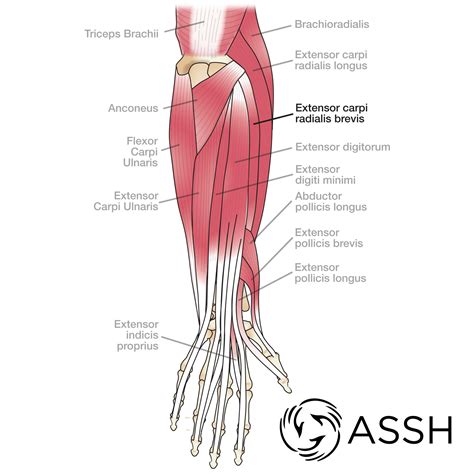 One tendons inserts onto the forearm bone, the radius, and the. Body Anatomy: Upper Extremity Tendons | The Hand Society