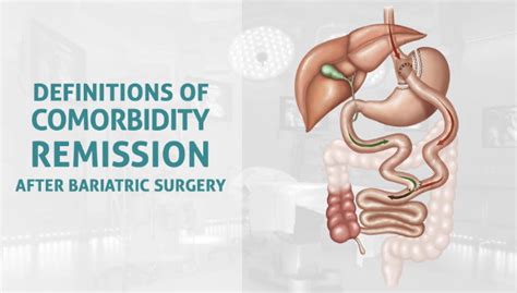 La comorbilidad describe el efecto de todas las demás afecciones que un paciente individual podría tener, además de la afección. Remisión de la comorbilidad después de cirugía bariátrica - Cirugía general y digestiva en ...