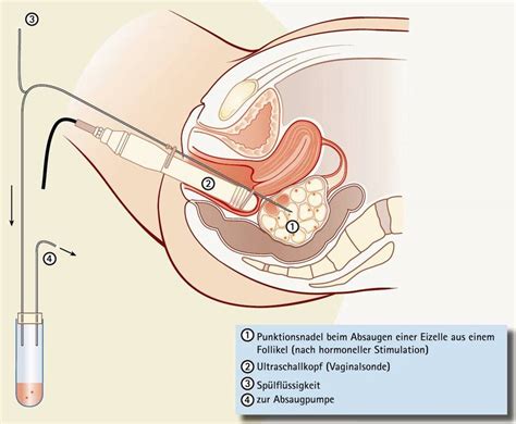 Sie sind eine wichtige erogene zone bei frauen. Wie kommen spermien in die gebarmutter. Problem, Sperma ...