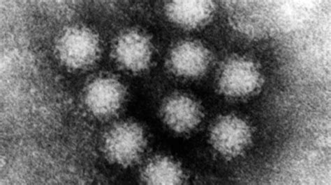 A major hindrance to norovirus research has been the lack of a system in which to grow the virus. Norovirus Buat Cemas Pejabat Olimpiade