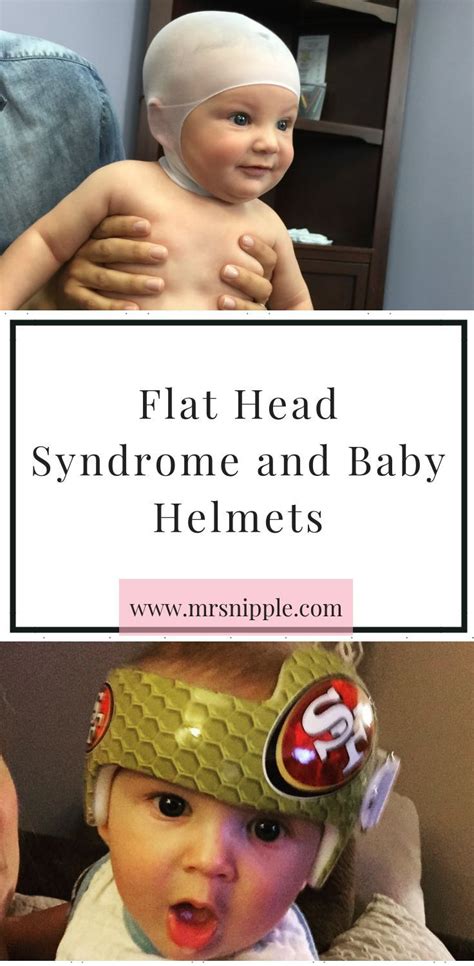 Babies with down syndrome take longer to talk. FLAT HEAD SYNDROME & BABY HELMETS | Baby helmet, Flat head ...