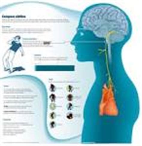 Síncope (fonología), la pérdida de uno o más sonidos, particularmente una vocal no estresada, desde el interior de una palabra. Síncope Neurogénico - EcuRed