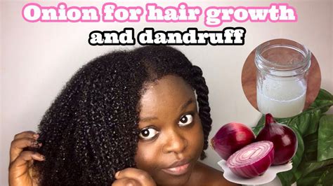 A small study from 2015 found that after using rosemary oil on the scalp for six months a healthy scalp is necessary if you want to promote healthy hair growth, which is why blood circulation is so important. THE BEST WAY TO USE ONIONS FOR HAIR GROWTH & DANDRUFF ...