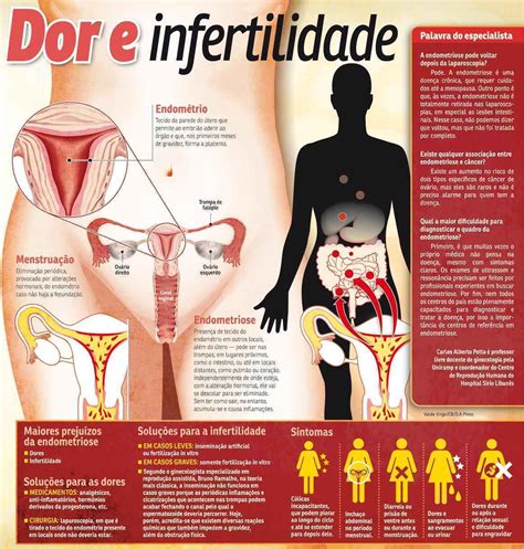 Welche symptome und folgen das haben kann und wie die erkrankung behandelt wird, lesen sie hier! Endometriose atinge 10% das mulheres entre 15 e 45 anos ...
