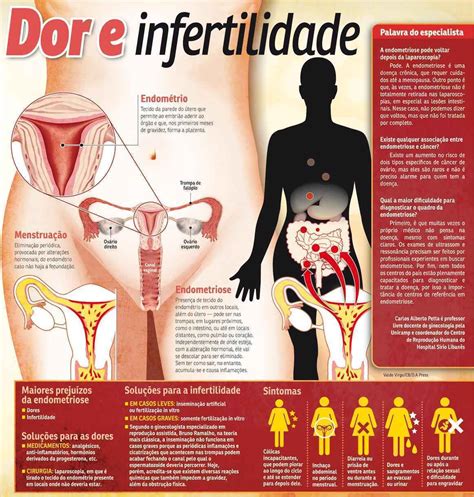 A endometriose é uma doença crônica que pode ser dolorosa. Endometriose atinge 10% das mulheres entre 15 e 45 anos ...