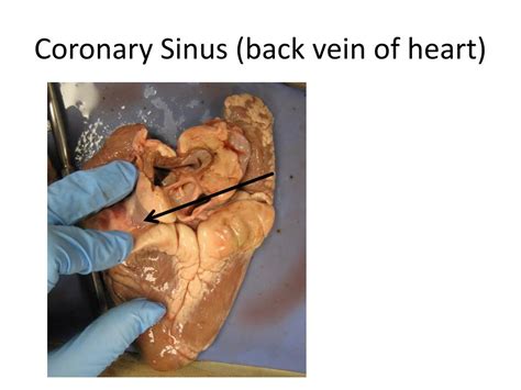 They branch and encircle the heart to cover its surface. PPT - Sheep Heart PowerPoint Presentation, free download ...