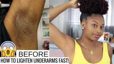 Whiten dark underarms instantly, underarms home remedy, how to get rid of dark underarms, homemade bleach, remove black. 2 MONTHS UPDATE! How To Lighten Dark Underarms Naturally ...