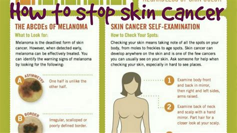 It helps determine how serious the cancer is and how best to treat it. How to check a mole on your skin for cancer - YouTube