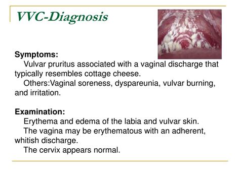 PPT - Genital Tract Infections PowerPoint Presentation ...
