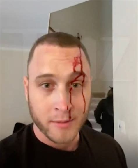 We consider the claims filed by kiana parker to be a shakedown… Tom Hanks' rapper son Chet claims ex attacked him with a knife in disturbing bloody video ...