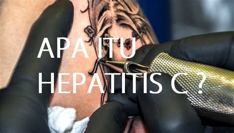 Terdapat beberapa genotip untuk virus hepatitis c: Apa Itu Hepatitis C ? - ydhartono.com