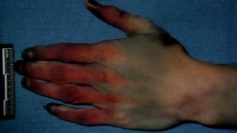 Prosecutors showed jurors graphic crime scene photos thursday in the colorado theater shooting trial, the first time images of the bloodshed were made public since the july 20, 2012, attack. cs11 - Crime Online