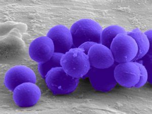 The area of redness often extends beyond the swelling. Was bedeutet PVL positive S.aureus / MRSA?