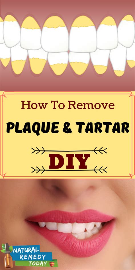 This then gets into bloodstream and binds to ldl cholesterol. How to Remove Plaque and Tartar and Whiten your Teeth ...