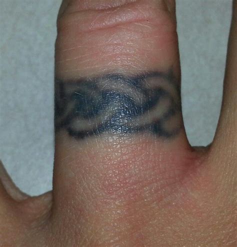 While tattoo removal has come far, 'tattoo regret' has continued to be a very real and relevant phenomenon. 1 hour after session #1 | Laser tattoo, Laser tattoo ...