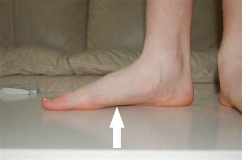 Hal ini ternyata bisa terkadang, telapak kaki sakit bisa menjadi semakin parah apabila terjadi pada orang yang berada. Masalah tapak kaki rata - Ini cara kenal pasti dan ...