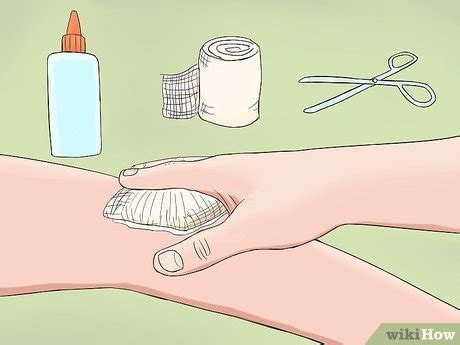 1 how to remove a cactus needle from under the skin. 4 formas de quitar espinas de cactus - wikiHow
