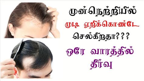 Similarly, cayenne pepper, honey, and olive oil stimulate hair growth. Hair growth tips for forehead in Tamil|முன்நெற்றியில் முடி ...