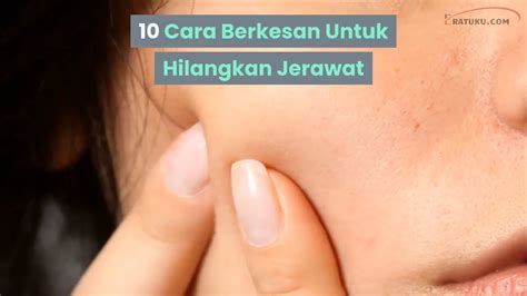 Banyak cara yang dilakukan orang untuk menghilangkan jerawat. 10 Cara Berkesan Untuk Hilangkan Jerawat - YouTube