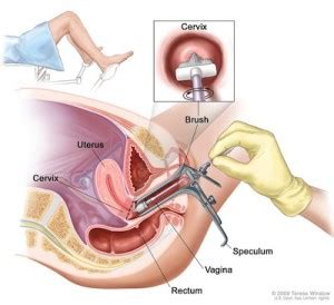 Automatik yang mana menjimatkan dari segi masa dan urusniaga. Ujian Pap Smear Bantu Kesan Ovarian Cyst | genkimomma.my