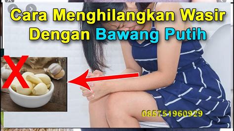 Sebelum ini, theasianparent malaysia ada berkongsi cara hilangkan kahak bayi dengan minyak bawang putih dan daun sireh. Cara Menghilangkan Wasir Dengan Bawang Putih | Tidak Bisa ...