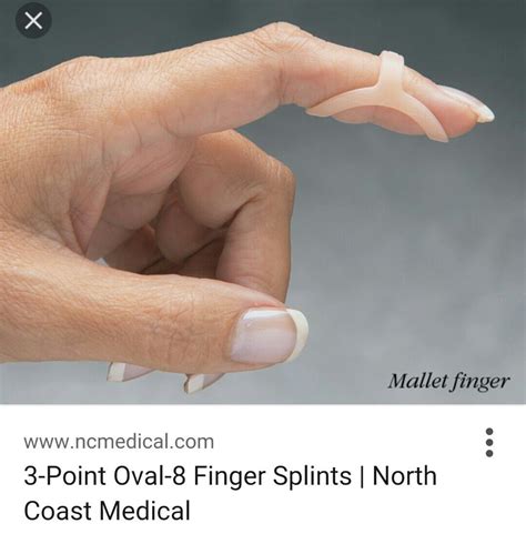 Splint for trigger-finger | Trigger finger, Trigger thumb, Finger
