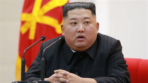 Nordkorea: Kim Jong-un nach OP offenbar in kritischem Zustand