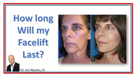 How does inflation impact my retirement income needs? How Long Will My Facelift Last? - YouTube