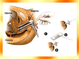 Maybe you would like to learn more about one of these? 24 / 7: Kanker Serviks vs Pembalut