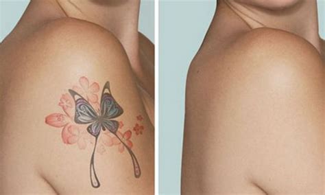 Flash tattoo ile evde geçici dövme yapma en kolay dövme yöntemlerinden biri de flash tattoo. Özel Bölgeye Dövme Yapımı / Evde Dovme Yapma Fikri ...