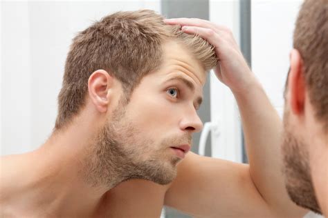 Men and women are battling with hair loss while in their 20s and 30s. Early Signs of Balding 2021 - Hair Loss Geeks