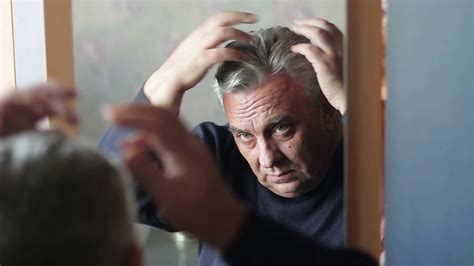 Yesterday i told you what they do not tell. Elderly man upset by hair loss or dandruff Stock Video ...
