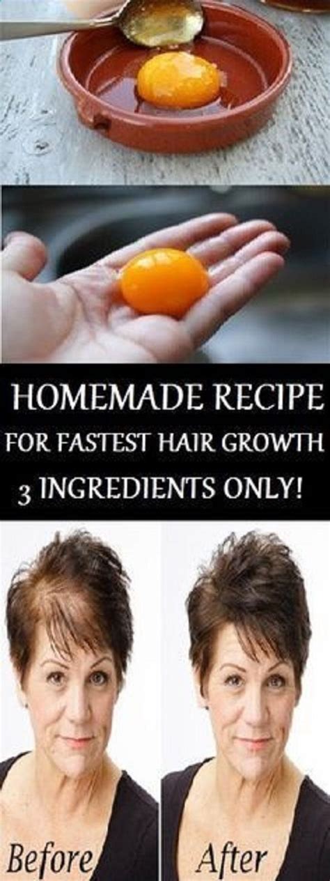 Besides, i had to identify and evaluate hair growth products that provide various minerals and essential nutrients that stimulate hair growth in the most natural way. The Magic Homemade Recipe For Fastest Hair Growth 3 ...