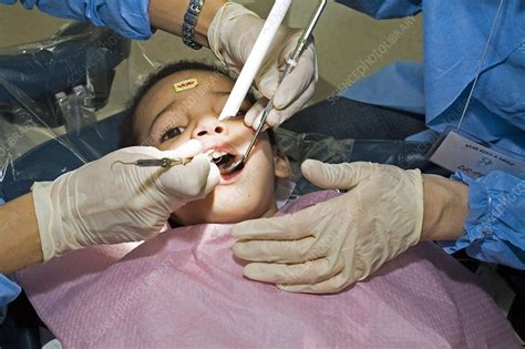 Childrens dental care of delray. Dental care for children - Stock Image - C020/3854 ...